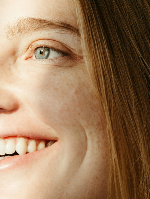 What Is Cortisol Face?